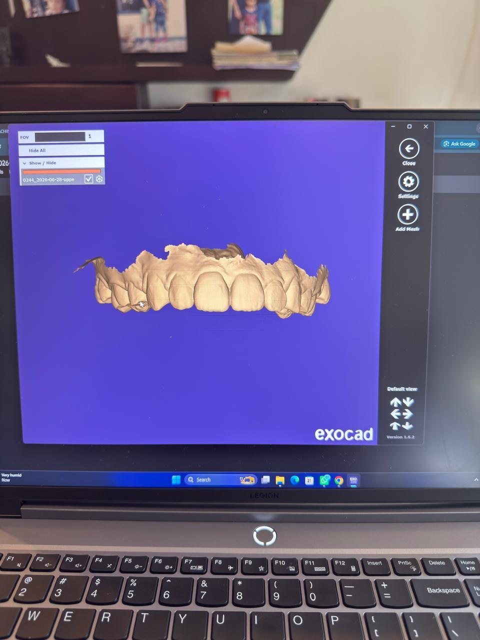 Upper jaw CAD scan for digital dentistry planning.